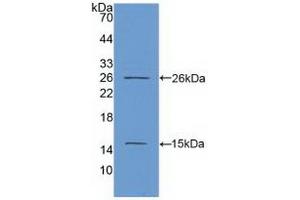Detection of Recombinant Ki67P, Human using Polyclonal Antibody to Ki-67 Protein (Ki-67) (Ki-67 anticorps  (AA 2815-2928))