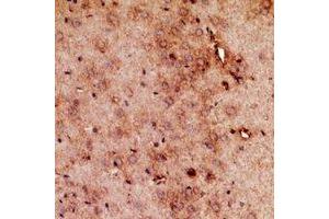 Immunohistochemical analysis of RRP7A/B staining in mouse brain formalin fixed paraffin embedded tissue section. (RRP7A/B (C-Term) anticorps)