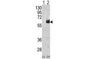 Image no. 1 for anti-Microtubule-Associated Protein tau (MAPT) (C-Term) antibody (ABIN357423)