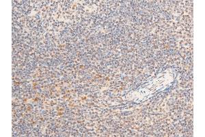 ABIN6267286 at 1/100 staining mouse spleen tissue sections by IHC-P.
