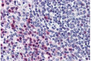 Human Spleen (formalin-fixed, paraffin-embedded) stained with STRAP antibody ABIN290242 at 10 ug/ml followed by biotinylated goat anti-rabbit IgG secondary antibody ABIN481713, alkaline phosphatase-streptavidin and chromogen. (STRAP anticorps  (AA 230-280))