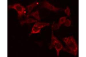 ABIN6274640 staining HepG2 cells by IF/ICC. (CYP26A1 anticorps  (Internal Region))