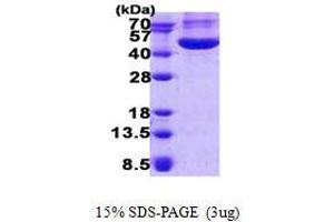 Image no. 1 for Chitinase 3-Like 1 (Cartilage Glycoprotein-39) (CHI3L1) (AA 22-383) protein (His-Myc tag) (ABIN6387124)