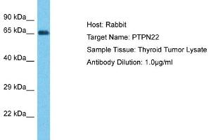 Host: Rabbit Target Name: PTPN22 Sample Type: Thyroid Tumor lysates Antibody Dilution: 1. (PTPN22 anticorps  (Middle Region))