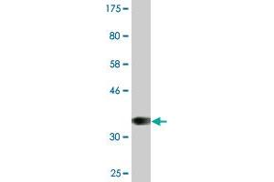 Western Blot detection against Immunogen (36. (Recoverin anticorps  (AA 101-199))