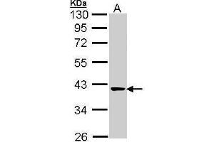WB Image Sample (30 ug of whole cell lysate) A: A431 , 10% SDS PAGE antibody diluted at 1:1000 (TALDO1 anticorps  (N-Term))