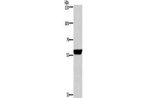 Gel: 6 % SDS-PAGE, Lysate: 40 μg, Lane: Mouse brain tissue, Primary antibody: ABIN7130690(PPP3CA Antibody) at dilution 1/650, Secondary antibody: Goat anti rabbit IgG at 1/8000 dilution, Exposure time: 1 second (PPP3CA anticorps)