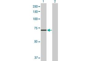Western Blot analysis of CPT2 expression in transfected 293T cell line by CPT2 MaxPab polyclonal antibody. (CPT2 anticorps  (AA 1-658))