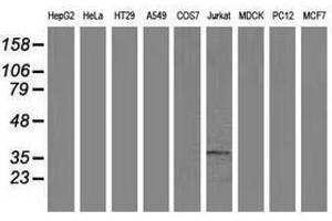 Image no. 3 for anti-Aminoacylase 3 (ACY3) antibody (ABIN1496463) (Aminoacylase 3 anticorps)