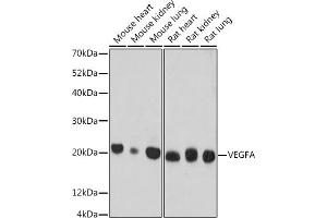 Western blot analysis of extracts of various cell lines, using VEGFA antibody (ABIN7271295) at 1:500 dilution.