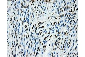 Immunohistochemical staining of paraffin-embedded Ovary tissue using anti-GRIPAP1mouse monoclonal antibody. (GRIPAP1 anticorps)