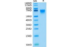 Human CD27/TNFRSF7 on Tris-Bis PAGE under reduced condition. (CD27 Protein (AA 21-192) (Fc Tag))