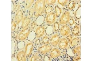 Immunohistochemistry of paraffin-embedded human kidney tissue using ABIN7154376 at dilution of 1:100 (GRHL2 anticorps  (AA 1-265))