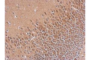 anti-S-Phase Kinase-Associated Protein 1 (SKP1) (AA 1-163) antibody