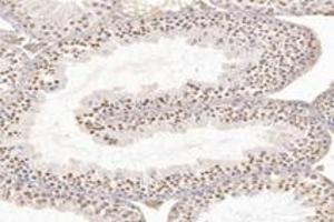 Immunohistochemistry analysis of paraffin-embedded rat testis using,WDR92 (ABIN7076222) at dilution of 1: 4200