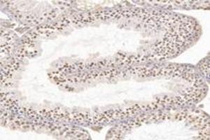 Immunohistochemistry analysis of paraffin-embedded rat testis using,WDR92 (ABIN7076222) at dilution of 1: 4200 (WDR92 anticorps)
