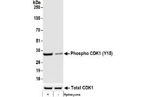 Western Blotting (WB) image for anti-Cyclin-Dependent Kinase 1 (CDK1) (pTyr15) antibody (ABIN7795624)