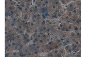 Detection of APOC1 in Human Liver Tissue using Polyclonal Antibody to Apolipoprotein C1 (APOC1)