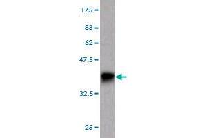 Western Blot detection against Immunogen (37. (GUCY2C anticorps  (AA 24-133))