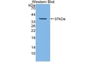 Western blot analysis of the recombinant protein. (IRF6 anticorps  (AA 150-445))
