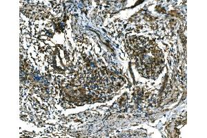 IHC analysis of RAB13 using anti-RAB13 antibody (ABIN7600599). (RAB13 anticorps  (AA 21-200))