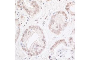 Immunohistochemistry (IHC) image for anti-AT Rich Interactive Domain 2 (ARID, RFX-Like) (ARID2) (AA 1785-1835) antibody (ABIN7453593)