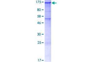 Image no. 1 for Seizure Related 6 Homolog Like (SEZ6L) (AA 1-948) protein (GST tag) (ABIN1319695)