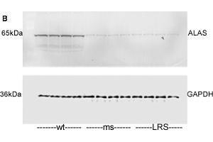 Mouse ferroportin, 5-aminolevulinic acid synthase (ALAS), and ferritin light chain (FLC) proteins are increased in sickle mice overexpressing human wt-FHC. (ALAS2 anticorps  (Center))