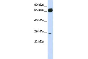 WB Suggested Anti-PRTFDC1 Antibody Titration:  0. (PRTFDC1 anticorps  (N-Term))