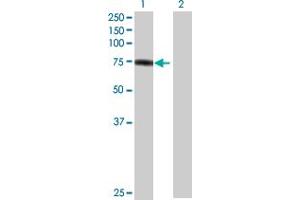 Western Blot analysis of PKP1 expression in transfected 293T cell line by PKP1 MaxPab polyclonal antibody. (Plakophilin 1 anticorps  (AA 1-726))