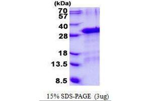 Figure annotation denotes ug of protein loaded and % gel used. (GFER Protéine)