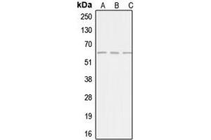 Western blot analysis of AGBL4 expression in HepG2 (A), Jurkat (B), HeLa (C) whole cell lysates. (AGBL4 anticorps  (C-Term))
