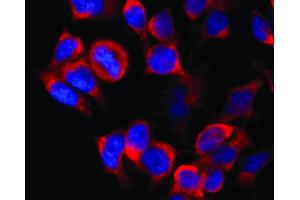Immunocytochemistry staining of vesicles (red) in RBL-2H3 rat basophilic leukemia cell line using anti-Kinesin (KN-02). (Kinesin (heavy chain) anticorps)