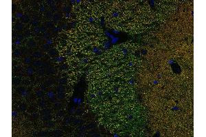 Indirect immunostaining of PFA fixed paraffin embedded mouse hippocampus section with anti-Piccolo (dilution 1 : 500; green) and rabbit anti-Homer 1 (, dilution 1 : 500; red). (Piccolo anticorps  (Center))