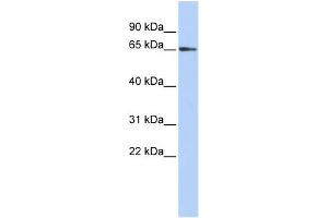 WB Suggested Anti-ZFP3 Antibody Titration:  0. (Zinc Finger Protein 3 Homolog (ZFP3) (N-Term) anticorps)
