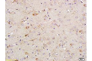 Formalin-fixed and paraffin embedded rat brain tissue labeled with Anti Phospho-TrkA (Tyr674/675) /TrkB (Tyr706/707) Polyclonal Antibody, Unconjugated (ABIN746618) at 1:200 followed by conjugation to the secondary antibody and DAB staining. (TRKA anticorps  (pTyr680, pTyr681))