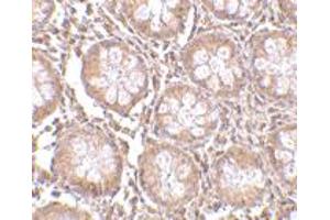 Immunohistochemistry of CD248 in human colon tissue with CD248 polyclonal antibody  at 2. (CD248 anticorps  (N-Term))