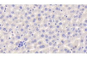 Detection of HPX in Rat Liver Tissue using Polyclonal Antibody to Hemopexin (HPX) (Hemopexin anticorps  (AA 31-242))