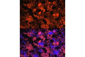 anti-Platelet Factor 4 (PF4) antibody
