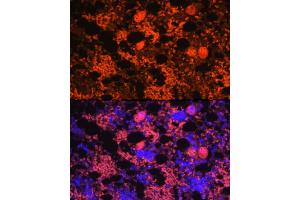 Immunofluorescence analysis of rat bone marrow using CXCL4/PF4 Rabbit pAb (ABIN7269400) at dilution of 1:100 (40x lens). (PF4 anticorps)