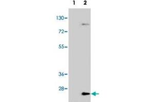 Western blot analysis of UBE2H (arrow) using UBE2H polyclonal antibody . (UBE2H anticorps  (C-Term))