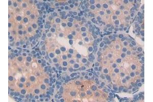 anti-Fatty Acid Binding Protein 9, Testis (FABP9) (AA 1-132) antibody