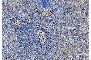 IHC analysis of Tropomyosin 2/TPM2 using anti-Tropomyosin 2/TPM2 antibody (ABIN7603245).