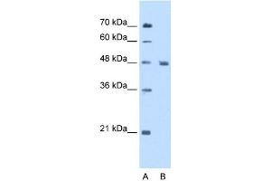 Enolase 3 antibody used at 5 ug/ml to detect target protein. (ENO3 anticorps)