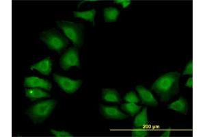 Immunofluorescence of monoclonal antibody to TXN on HeLa cell. (TXN anticorps  (AA 1-105))