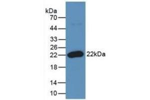 Detection of Recombinant RANkL, Human using Monoclonal Antibody to Receptor Activator Of Nuclear Factor Kappa B Ligand (RANkL)