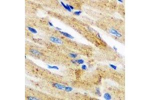 Immunohistochemical analysis of Epsilon-sarcoglycan staining in mouse heart formalin fixed paraffin embedded tissue section. (SGCE anticorps)