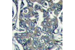 Image no. 1 for anti-Eukaryotic Translation Initiation Factor 4E Family Member 2 (EIF4E2) (N-Term) antibody (ABIN357298)