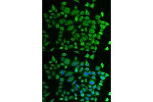 Immunofluorescence analysis of HeLa cells using P4HTM antibody (ABIN6292983). (P4HTM anticorps)