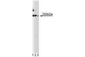 Western blot analysis of LR11 on a rat cerebrum lysate. (SORL1 anticorps  (AA 1220-1337))